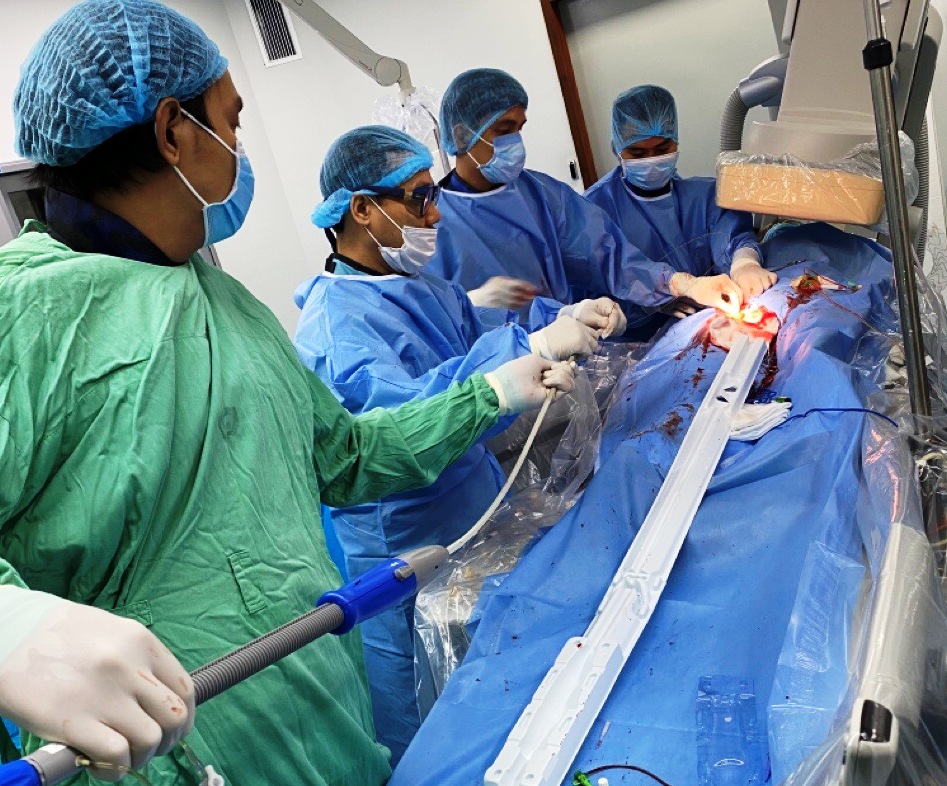 Cứu sống bệnh nhân bị phình bóc tách động mạch chủ phức tạp