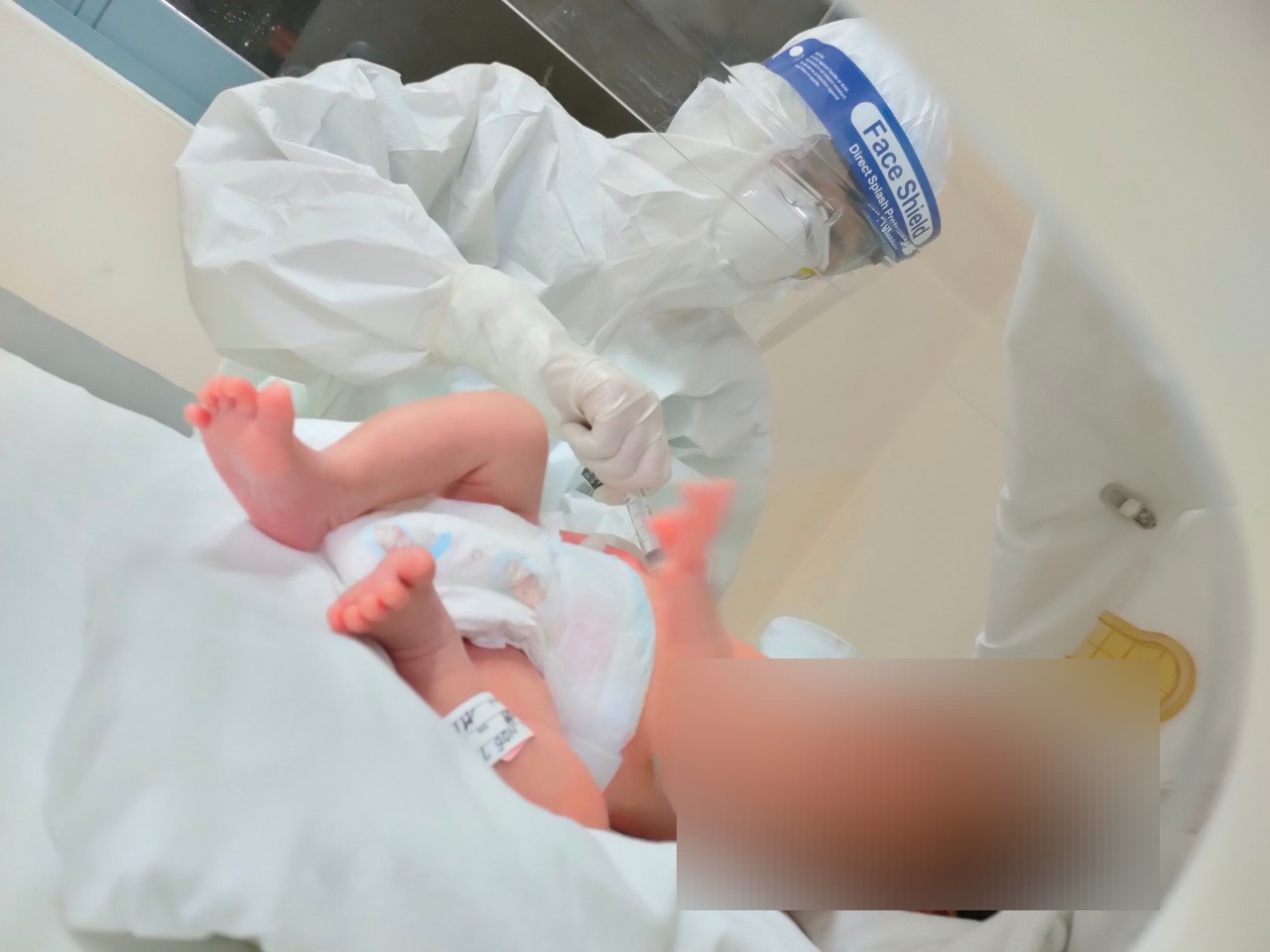 Successfully saving a pregnant woman with severe COVID-19