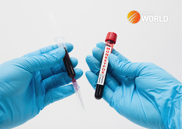 Thái Lan họp khẩn thảo luận biện pháp đối phó bệnh đậu mùa khỉ