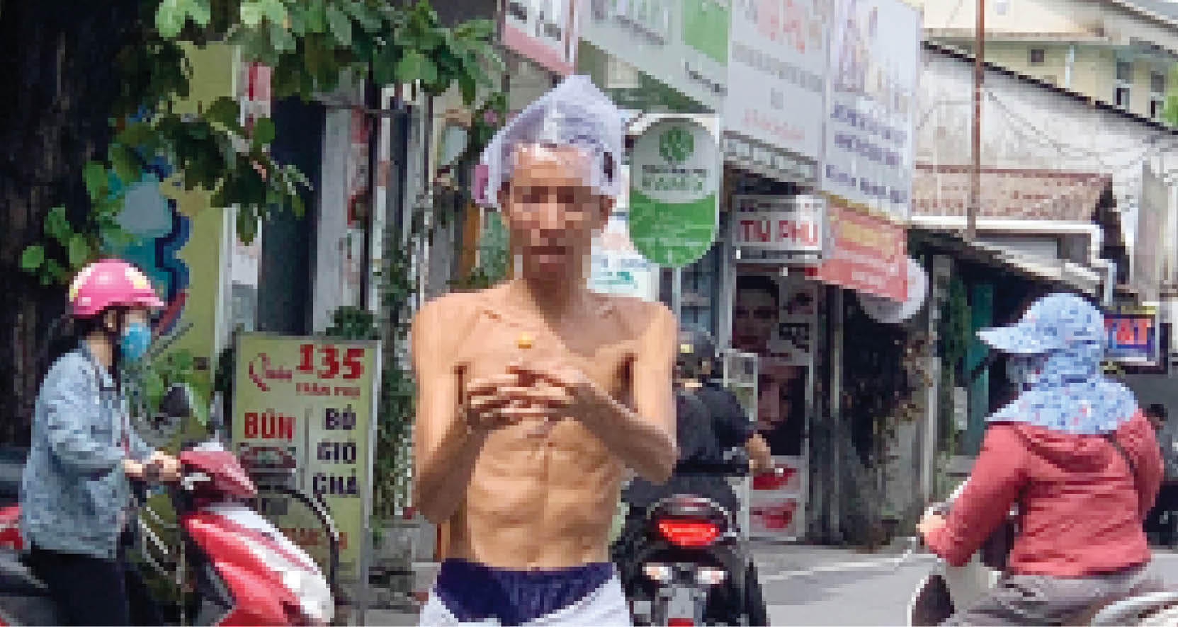 Cần quản chặt người bệnh tâm thần