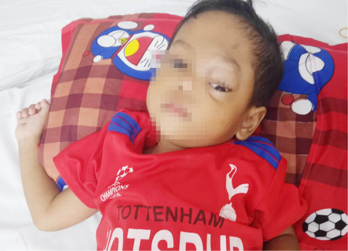 Xin yêu thương đến với hoàn cảnh cháu Thanh Phúc